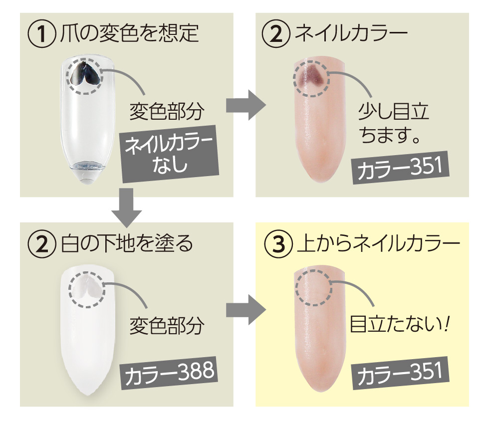 変色には388の白+カラーがおすすめ!