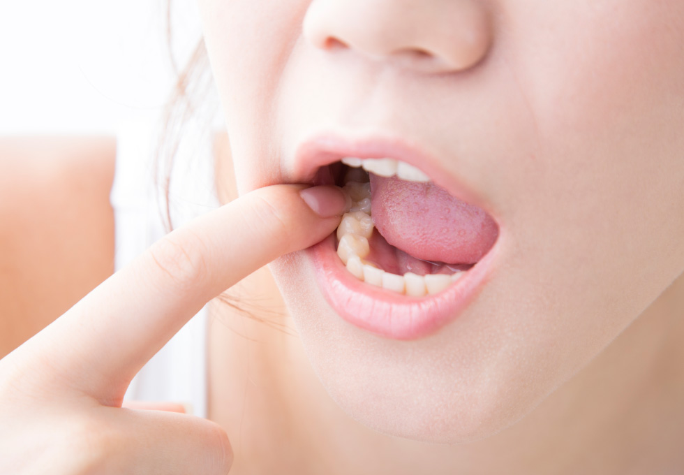 ジェントルマウスジェルの使い方