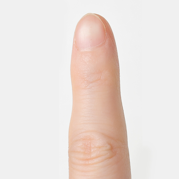 ゲットイーブン使用前