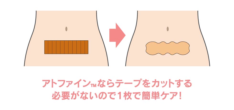 傷あとを1枚で簡単ケア
