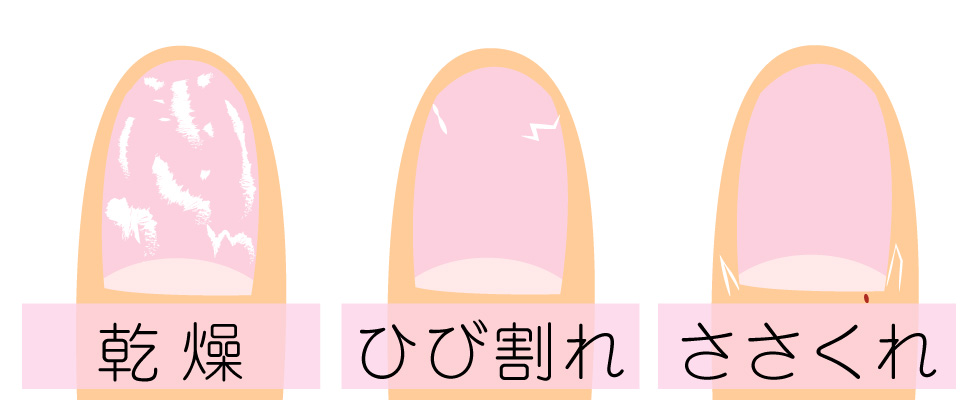 爪まわりの保湿オイル ネイルケア 抗がん剤での脱毛 医療用帽子 医療用かつら ウィッグ 下着通販ならレディスsvストア